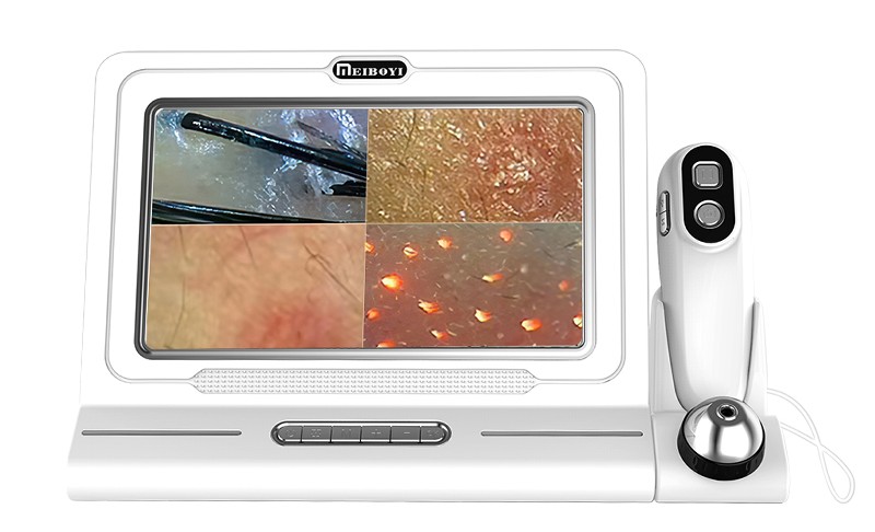 Cilt ve Saç Analiz Kamerası - Görsel 6